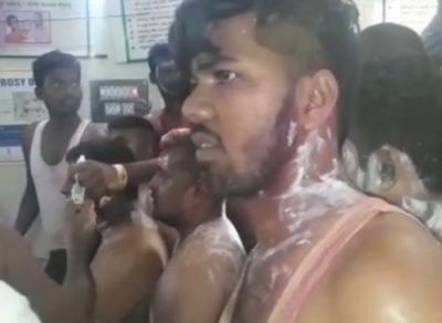 25 injured in acid attack at Congress victory rally in K’taka