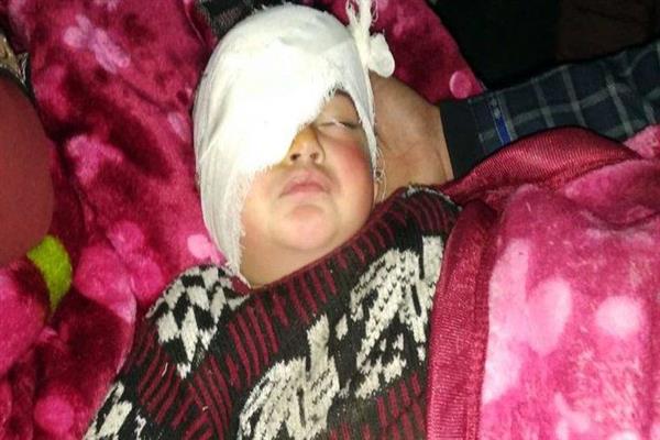 SHRC sends notices to DC, SSP Shopian over grave pellet injury to 20 month old Hiba