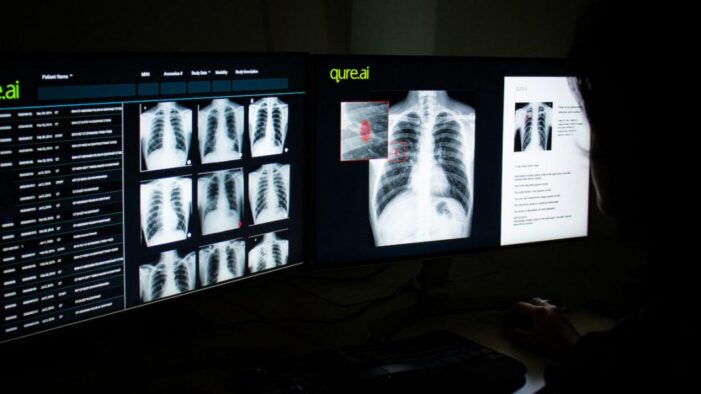 From X-rays detecting infection to virtual OPD — how NIC is using AI to fight Covid