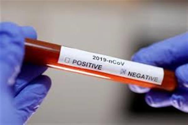 Family quarantined in Kanihama Budgam awaits for Covid-19 sampling