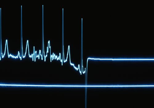SSB jawan dies of heart attack in Budgam SSB jawan dies of heart attack in Budgam