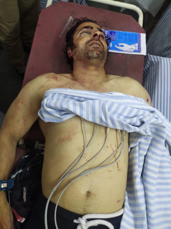Advocate Babar Qadri shot dead in Srinagar’s Hawal area