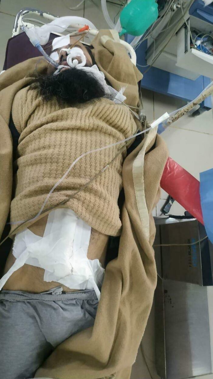 Militant who was critically injured in Anantnag gunfight succumbs