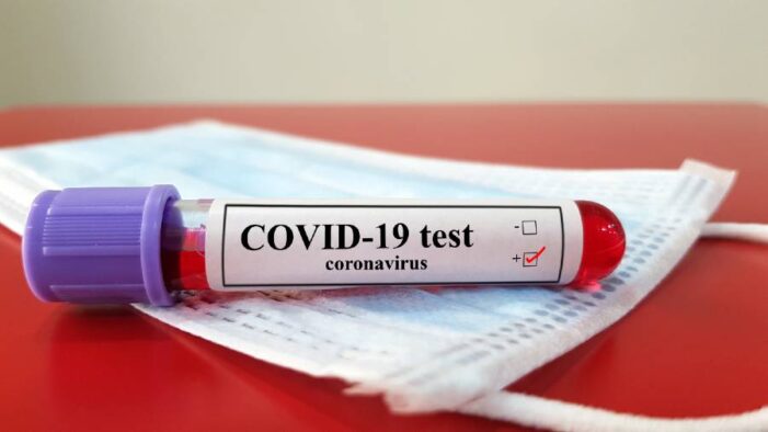 Active Covid Cases In Country Dip To 3,402 Active Covid Cases In Country Dip To 3,402