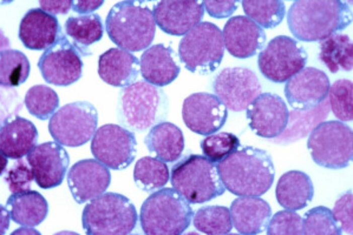 Cancer should be declared as notified disease, says Parliamentary panel
