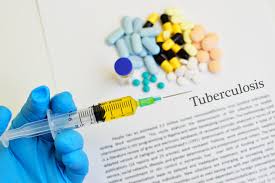 AI-Based System Introduced For Detecting TB Cases In Kashmir
